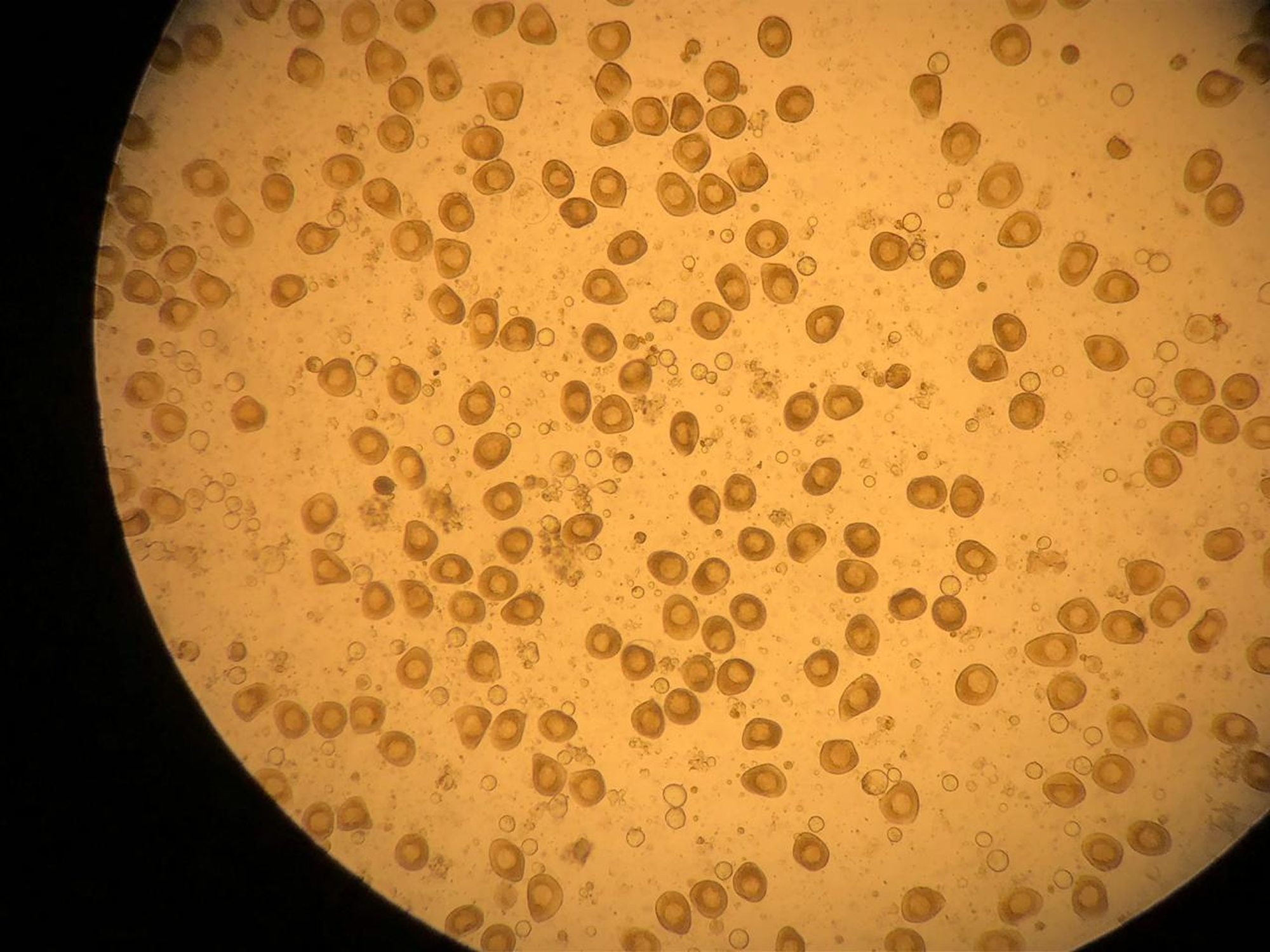Ovócito do marisco — LAB
